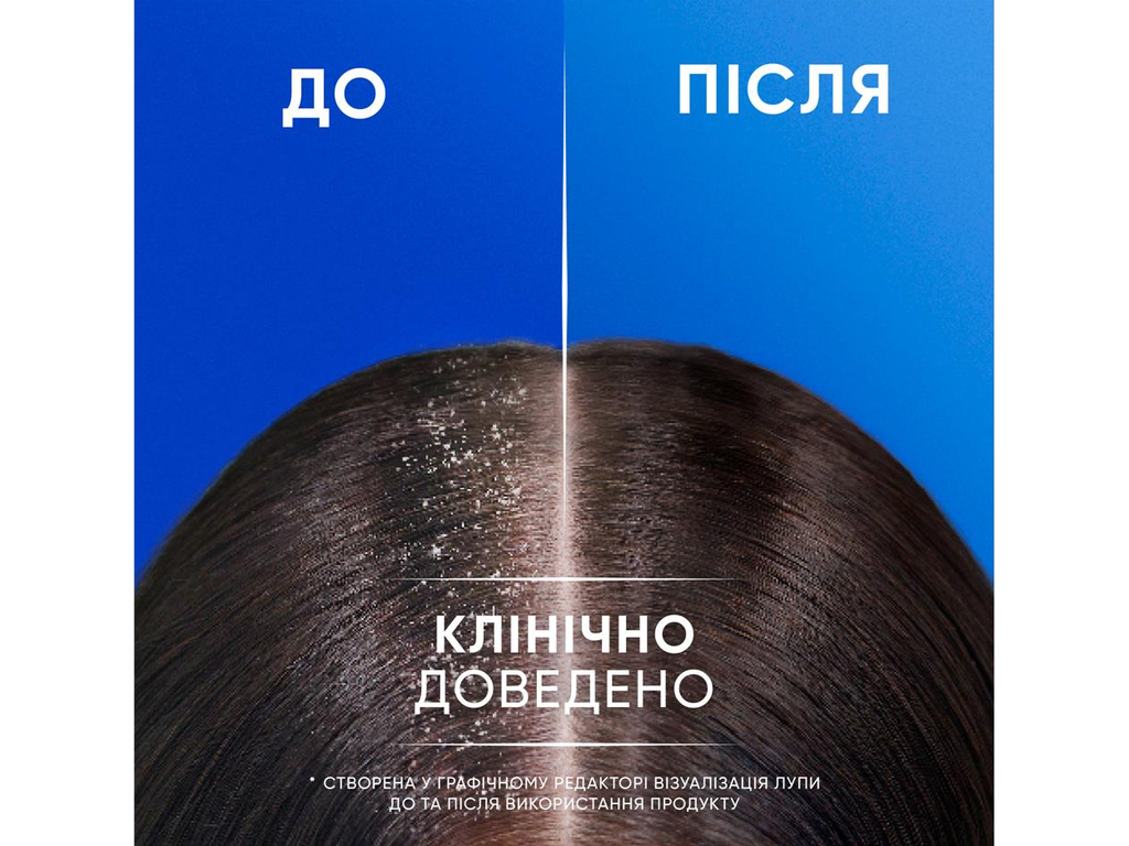 Шампунь 2 в 1 Head &amp; Shoulders Яблучна свіжість проти лупи, без силікону, 330мл