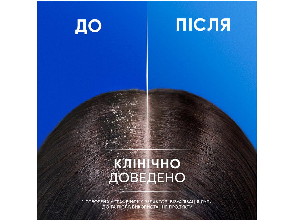 Шампунь Head & Shoulders и бальзам-ополаскиватель против перхоти 2в1, Свежесть ментола, 400мл