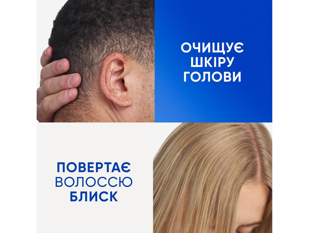 Шампунь Head Shoulders Очищення та блиск, проти лупи, з яблучним оцтом, 400мл
