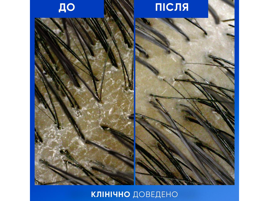 Шампунь Head Shoulders Очищення та блиск, проти лупи, з яблучним оцтом, 400мл