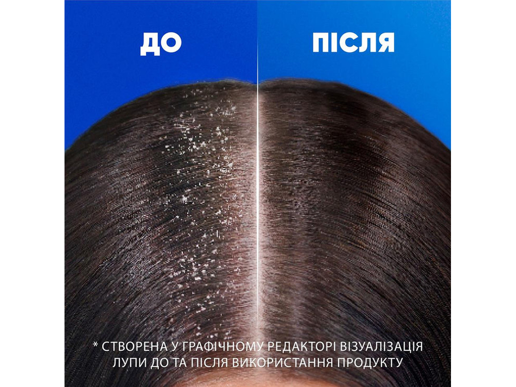 Шампунь против перхоти Head&Shoulders Яблучная свежесть, 400мл